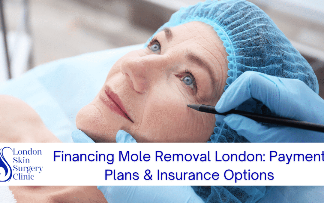 Financing Mole Removal London: Payment Plans & Insurance Options