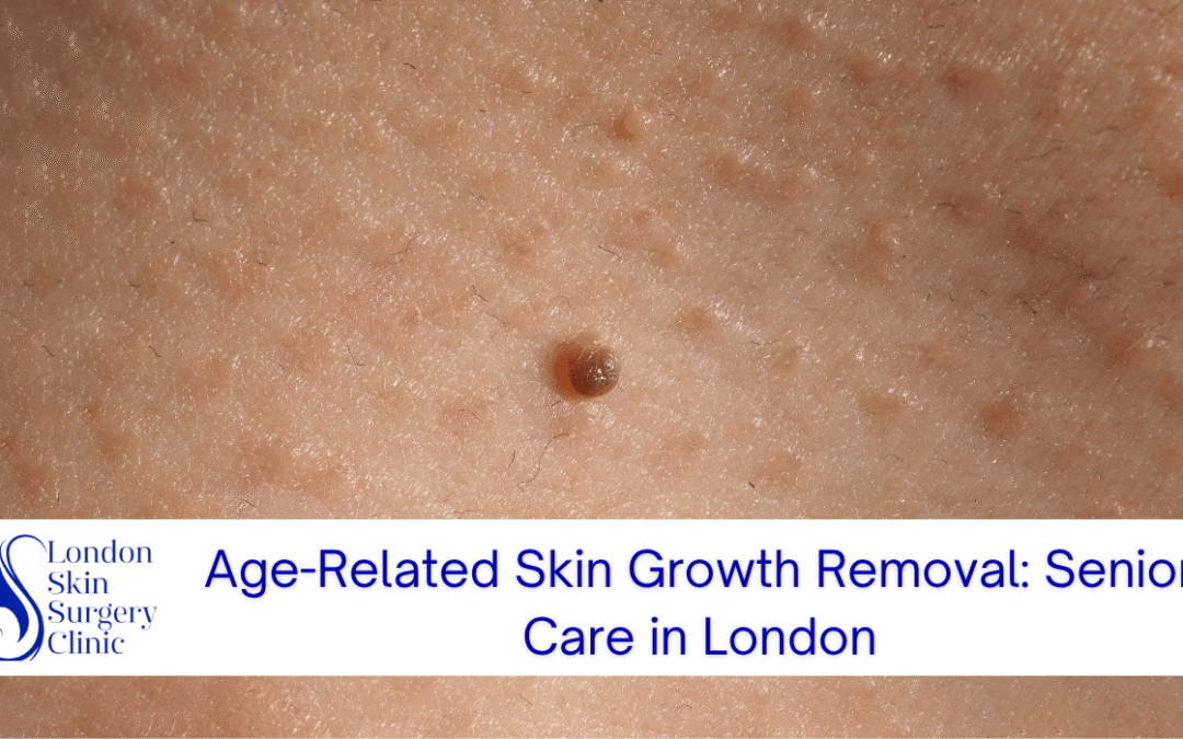 age related skin growth removal senior care