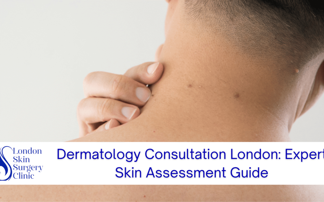 dermatology consultation london expert skin assessment
