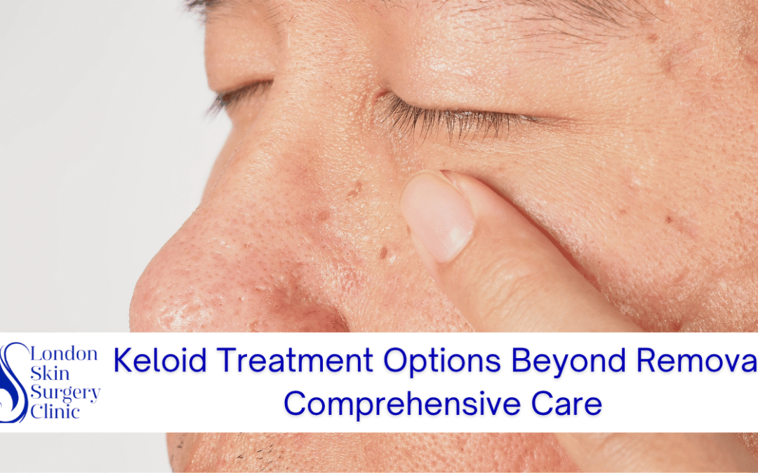 keloid treatment options comprehensive care london