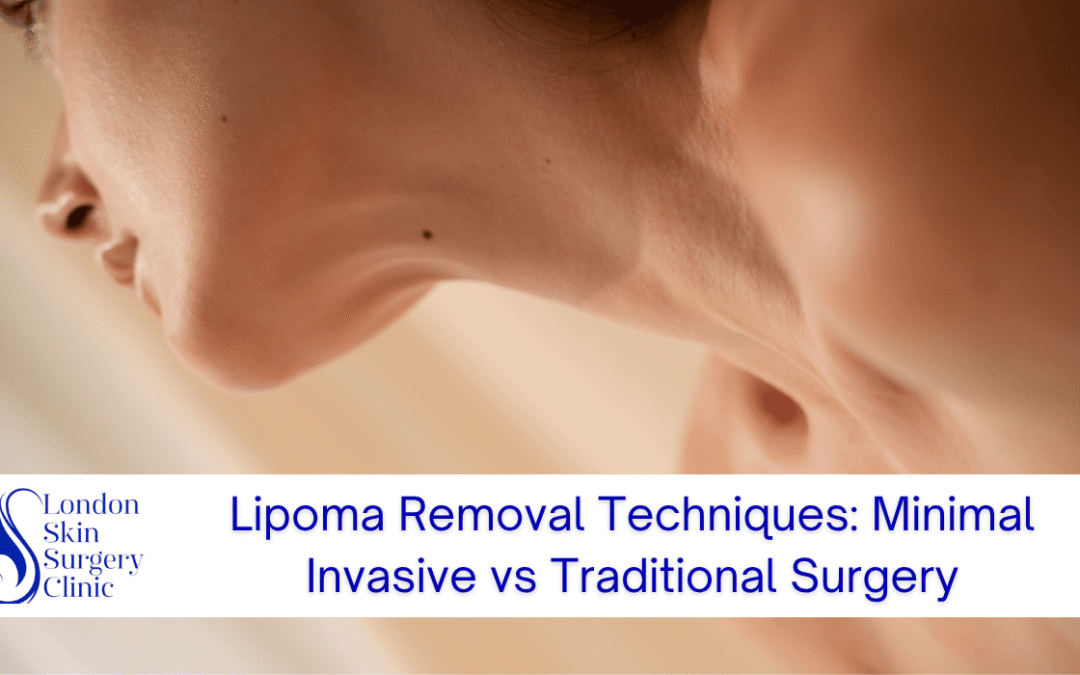 Lipoma Removal Techniques: Minimal Invasive vs Traditional Surgery