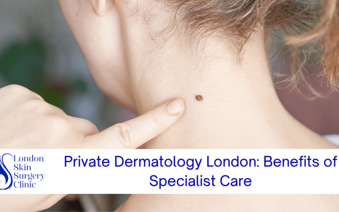 private dermatology london specialist care benefits
