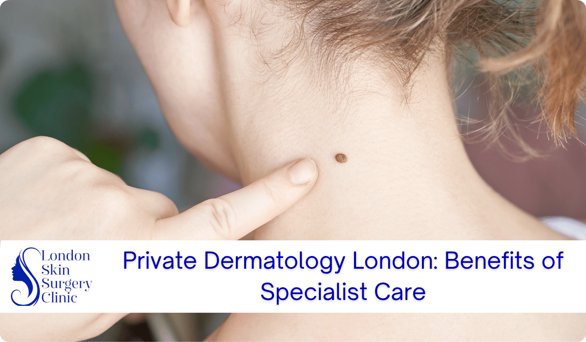 private dermatology london specialist care benefits private dermatology london specialist care benefits
