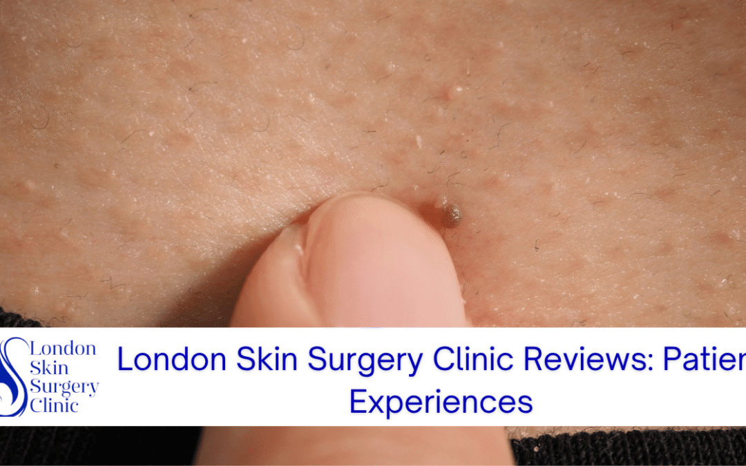 london skin surgery clinic reviews patient experiences