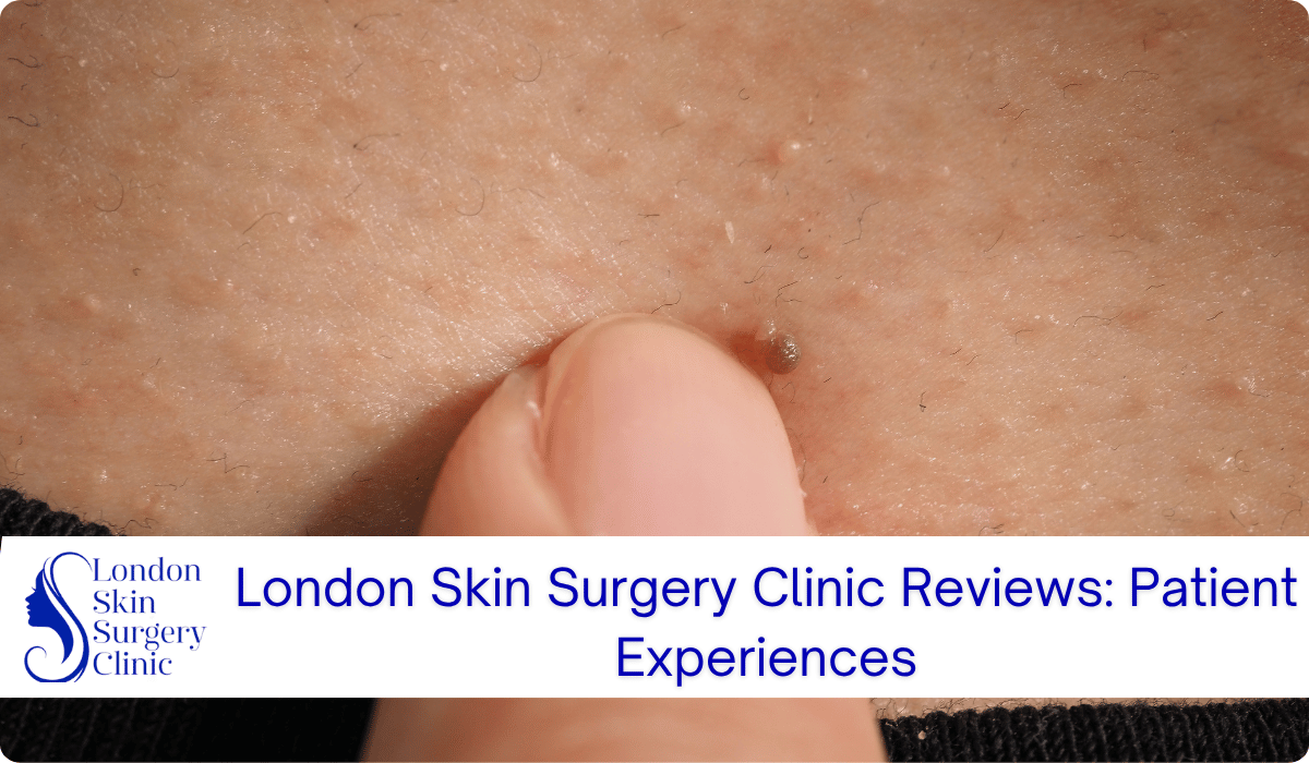london skin surgery clinic reviews patient experiences london skin surgery clinic reviews patient experiences
