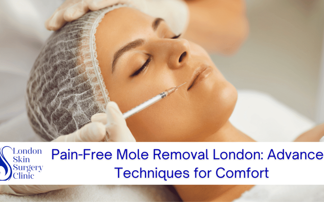 Pain-Free Mole Removal London: Advanced Techniques & Recovery Tips