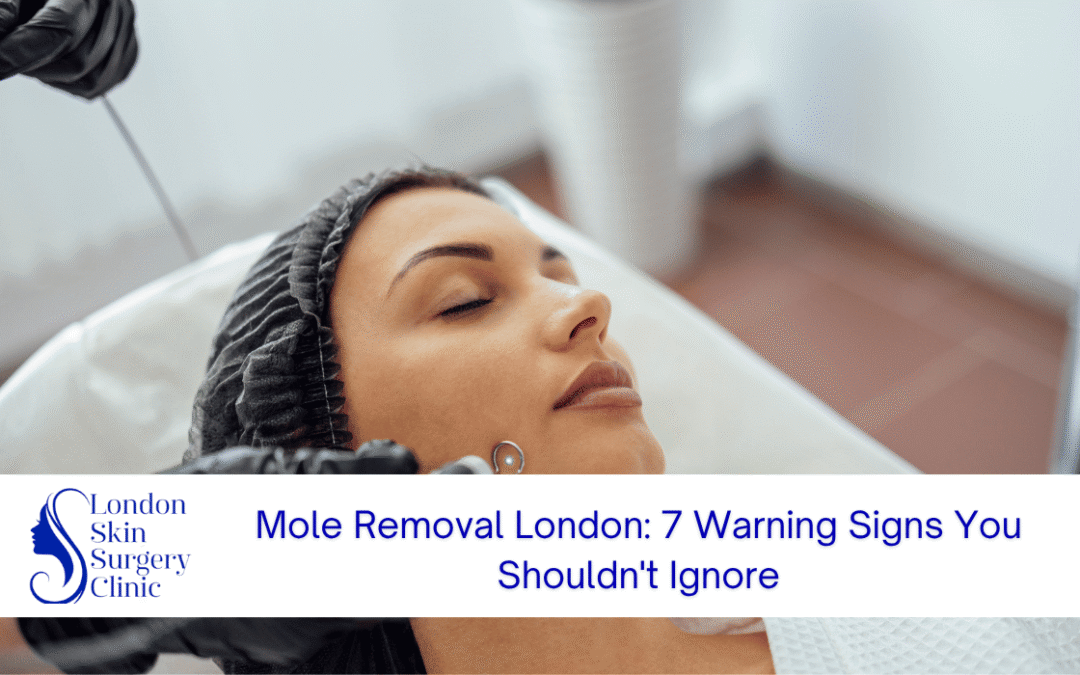 mole removal london warning signs ignore