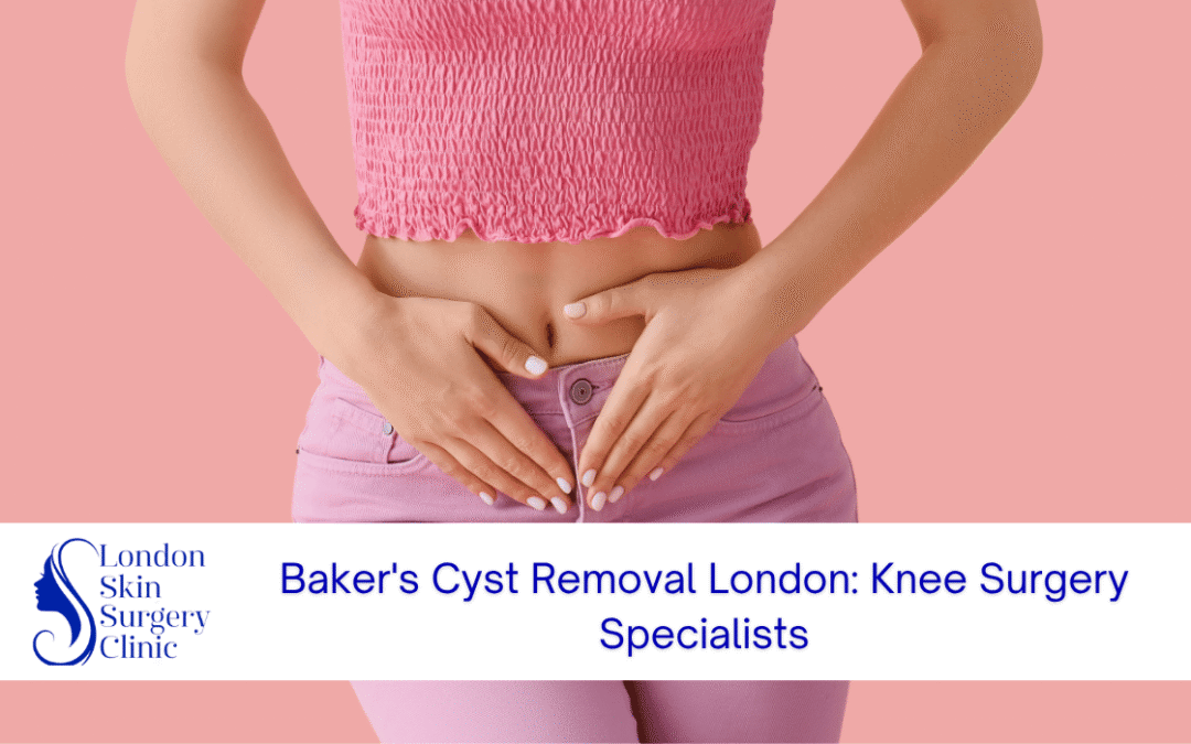 bakers cyst removal london knee surgery specialists