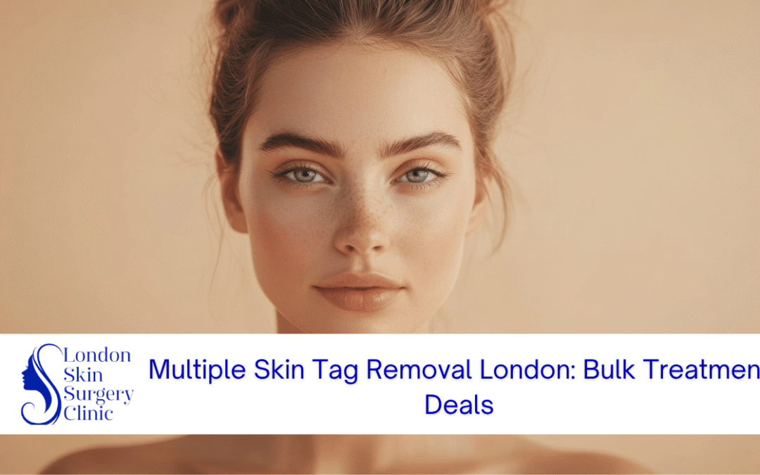 multiple skin tag removal london bulk treatment
